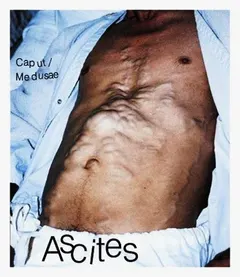 Ascites – Caput / Medusae (CDr, Album)
