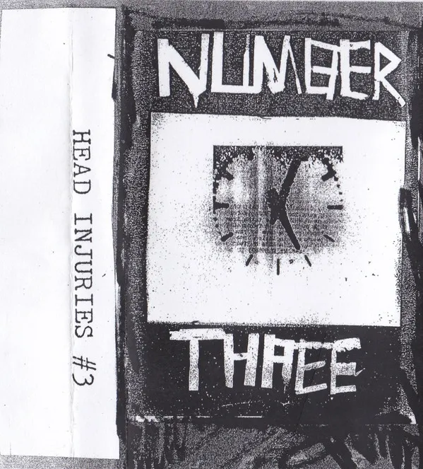 Head Injuries – Number Three