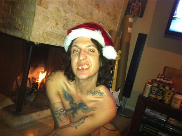 Mickey Avalon – Two Front Teeth