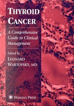Thyroid Cancer by Leonard Wartofsky